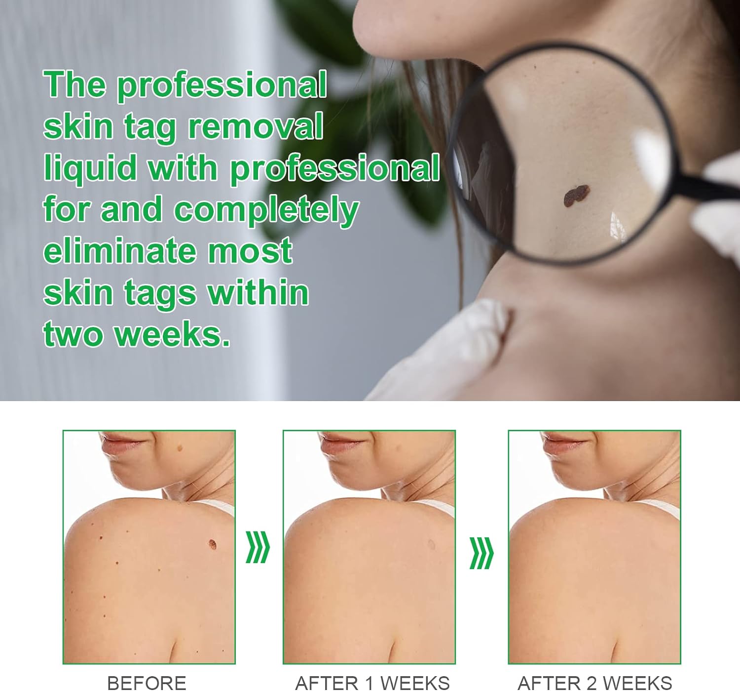 Crema pentru indepartarea negilor si alunitelor , 20 gr. Aliver Crema pentru indepartarea negilor si alunitelor , 20 gr. Aliver