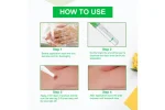 Tratament natural pentru eliminarea etichetelor pielii , Skin Tag Remover Pen ,5 buc. Aliver