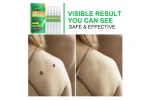 Tratament natural pentru eliminarea etichetelor pielii , Skin Tag Remover Pen ,5 buc. Aliver